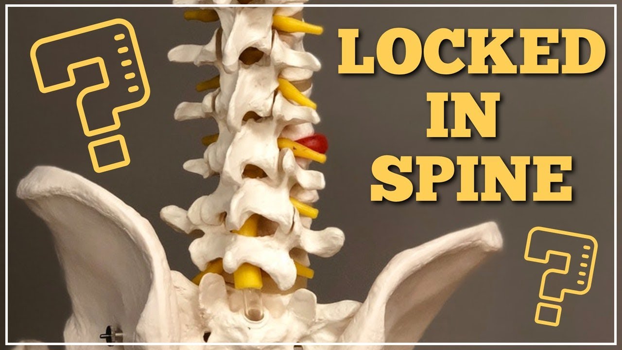 How A Locked-In Spine Can Help Your Back Pain or Sciatica 