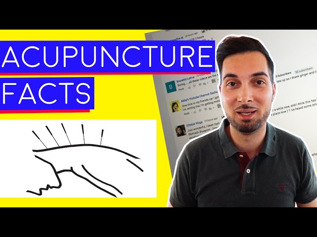 Acupuncture | What Is Acupuncture | How Does Acupuncture Work 