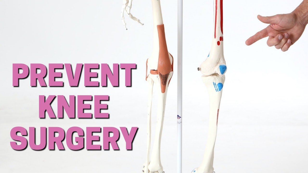 The 3 Things You Should Try BEFORE Knee Surgery or Replacement + Giveaway 