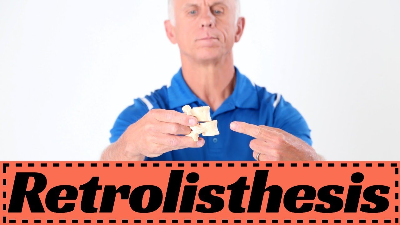 Retrolisthesis Back Pain: 5 Best Exercises/ Treatment to STOP Pain 