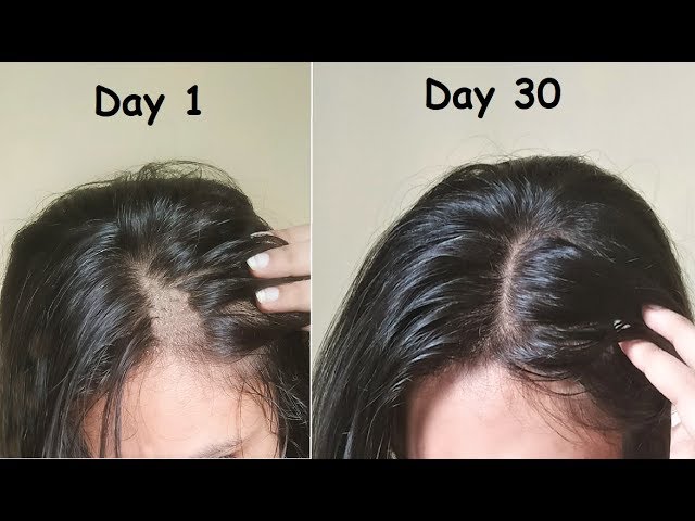 Thin Hair to Thick Hair in 30 Days - Carrot + Flaxseed + Aloevera Gel for Hair Growth & Long Hair 