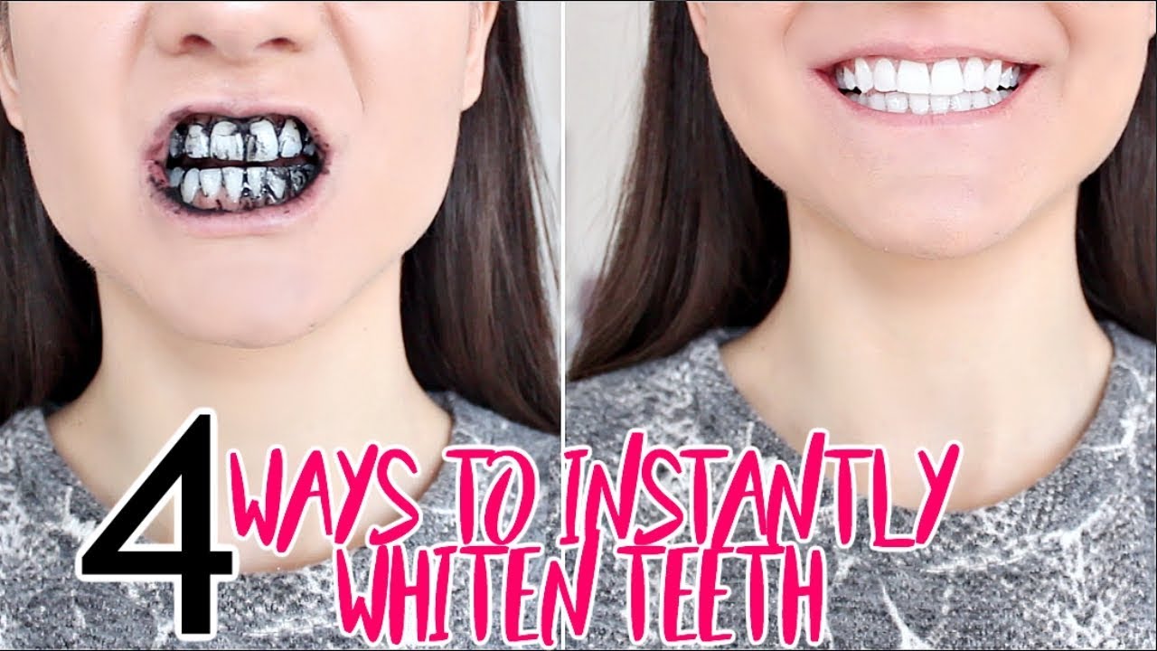 How To INSTANTLY WHITEN YOUR TEETH !! 