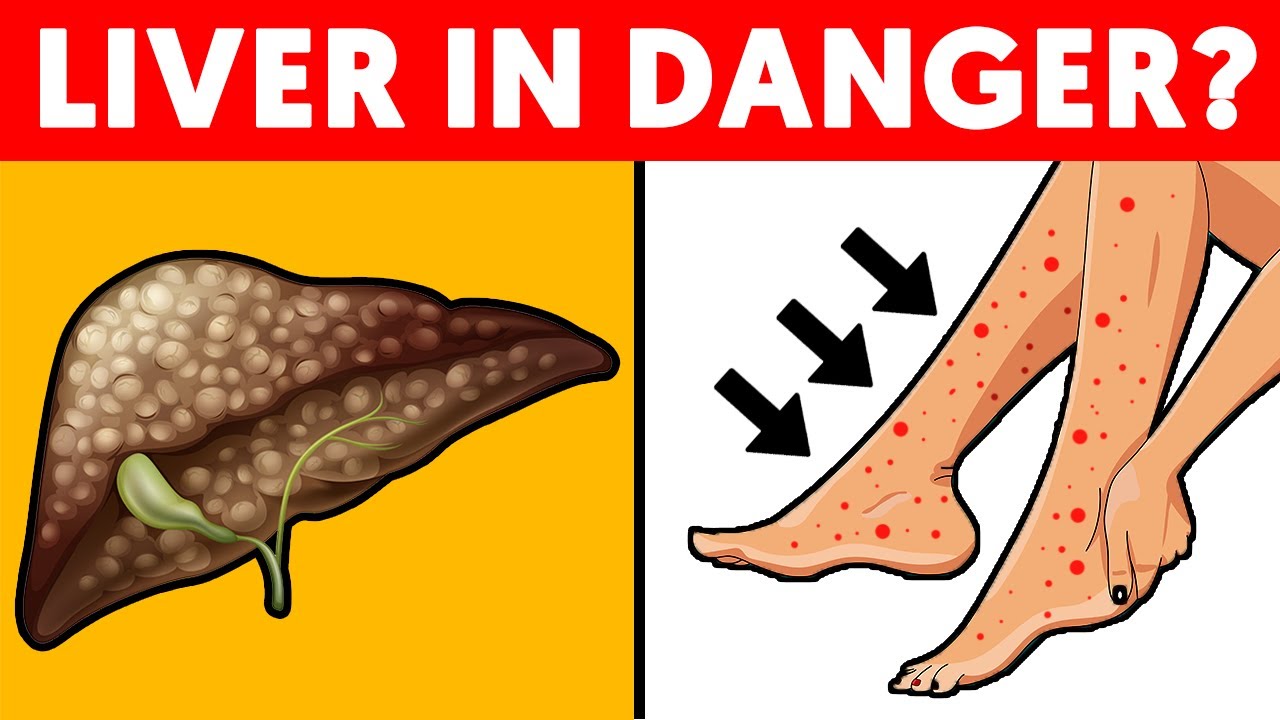 5 Signs of Liver problems hidden in your feet 