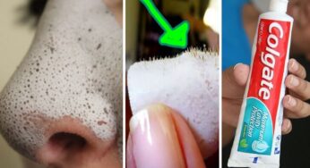 I Never Imagined That Toothpaste and Salt Could Remove Blackheads on Nose and Face Naturally