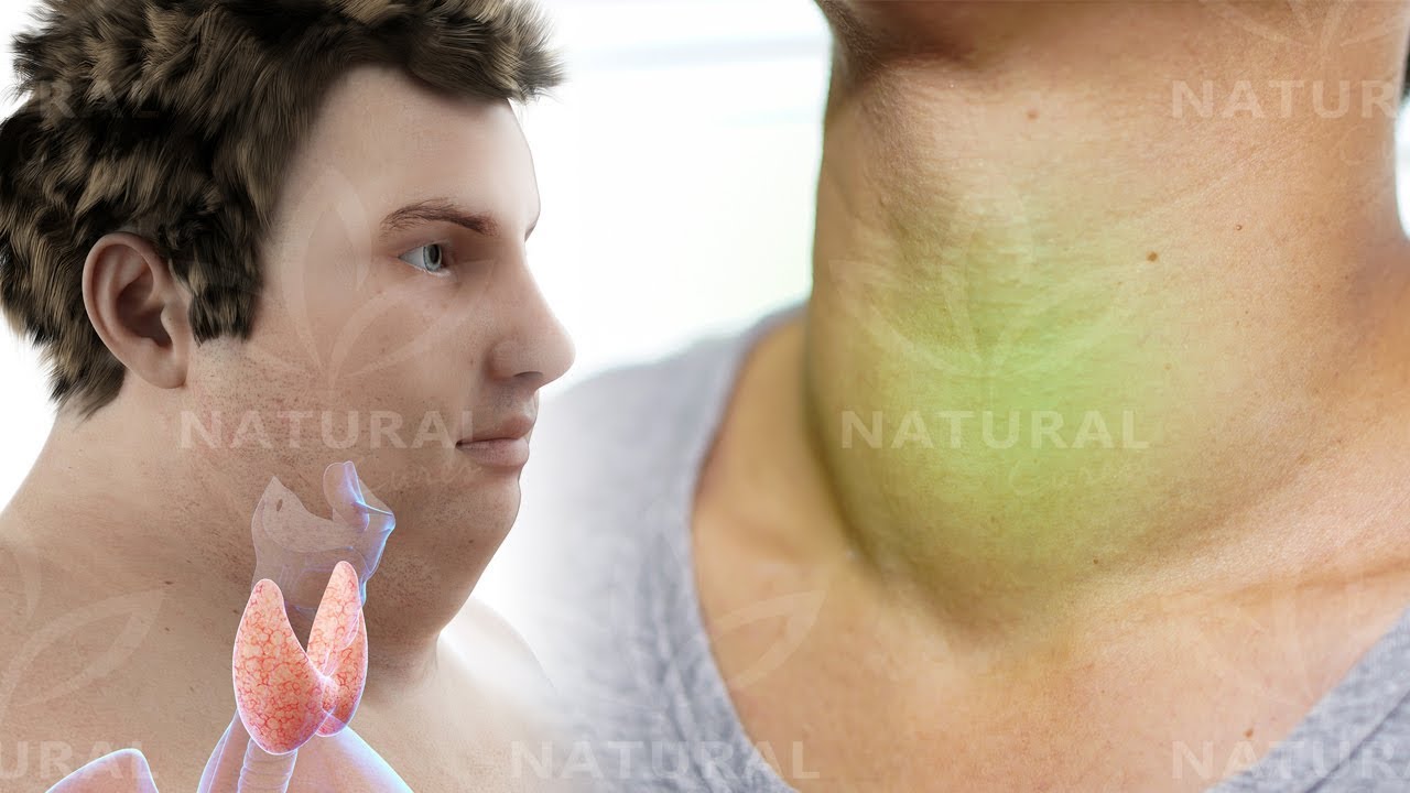 8 Silent Symptoms Of Thyroid Issues To Watch Out For 