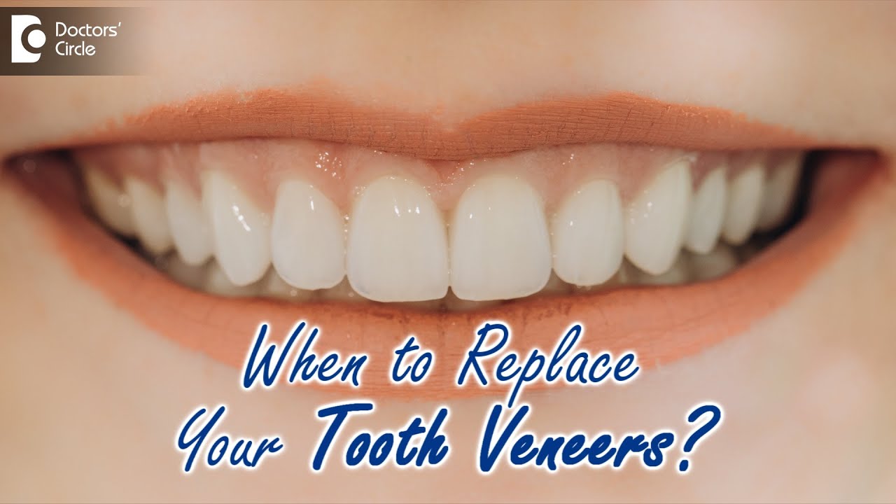 Right Time to do Tooth Veneer | EXPERT OPINION ON VENEER- Dr. Deepa Jayashankar | Doctors' Circle 