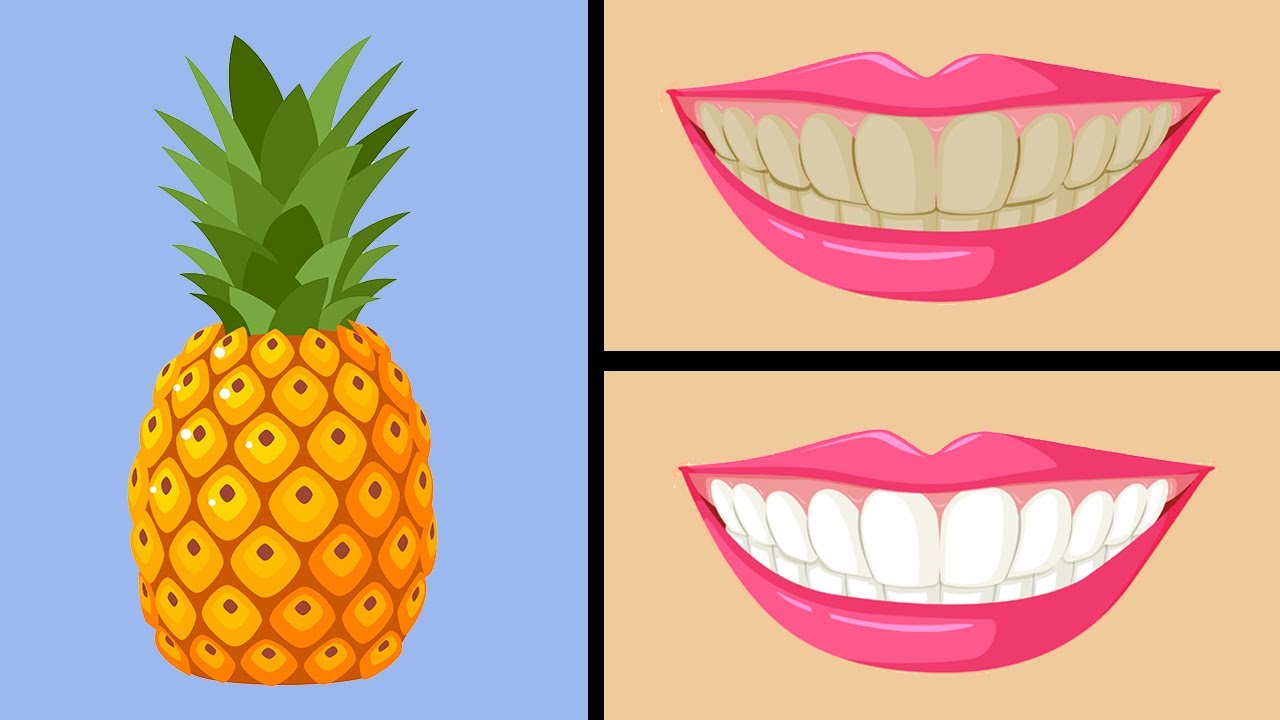 5 Foods that Naturally Whiten your Teeth Fast 