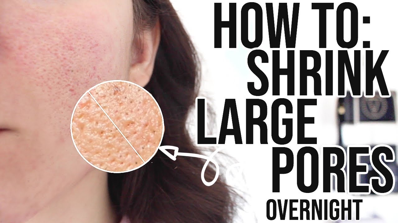 How To Get Rid Of Large Pores OVERNIGHT !! 