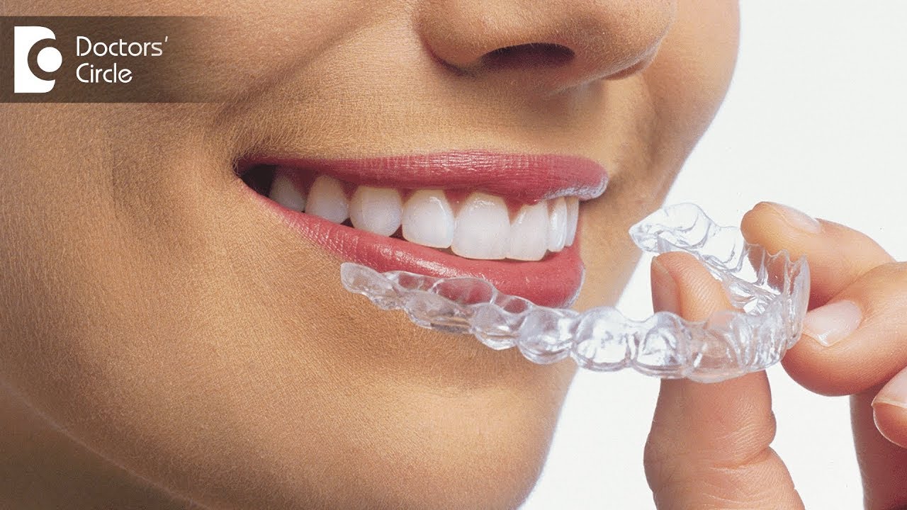 How do Invisible Braces work? - Dr Girish P V 