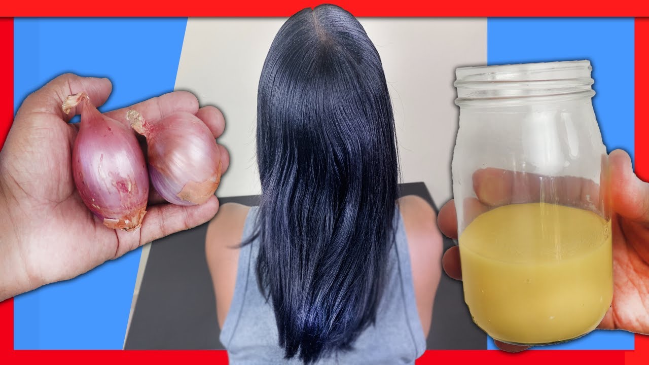 CABELLO LARGO RÁPIDO con Cebolla | 2 Remedios...Funcionan?/ Crecer el cabello NATURAL 