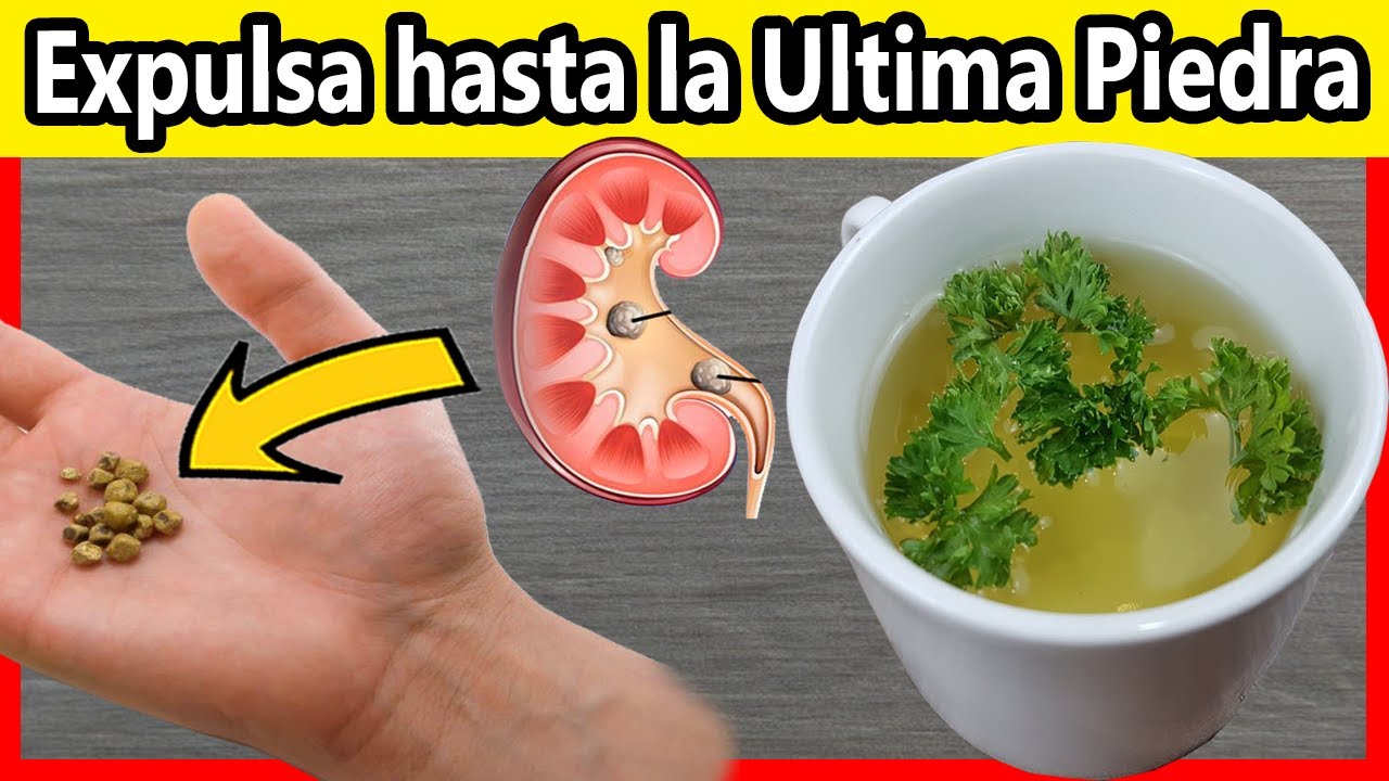 ?Hierve 1 poco de PEREJIL y Expulsa Hasta la última PIEDRA de los RIÑONES. ¡NO DEJES DE PROBARLO!? 