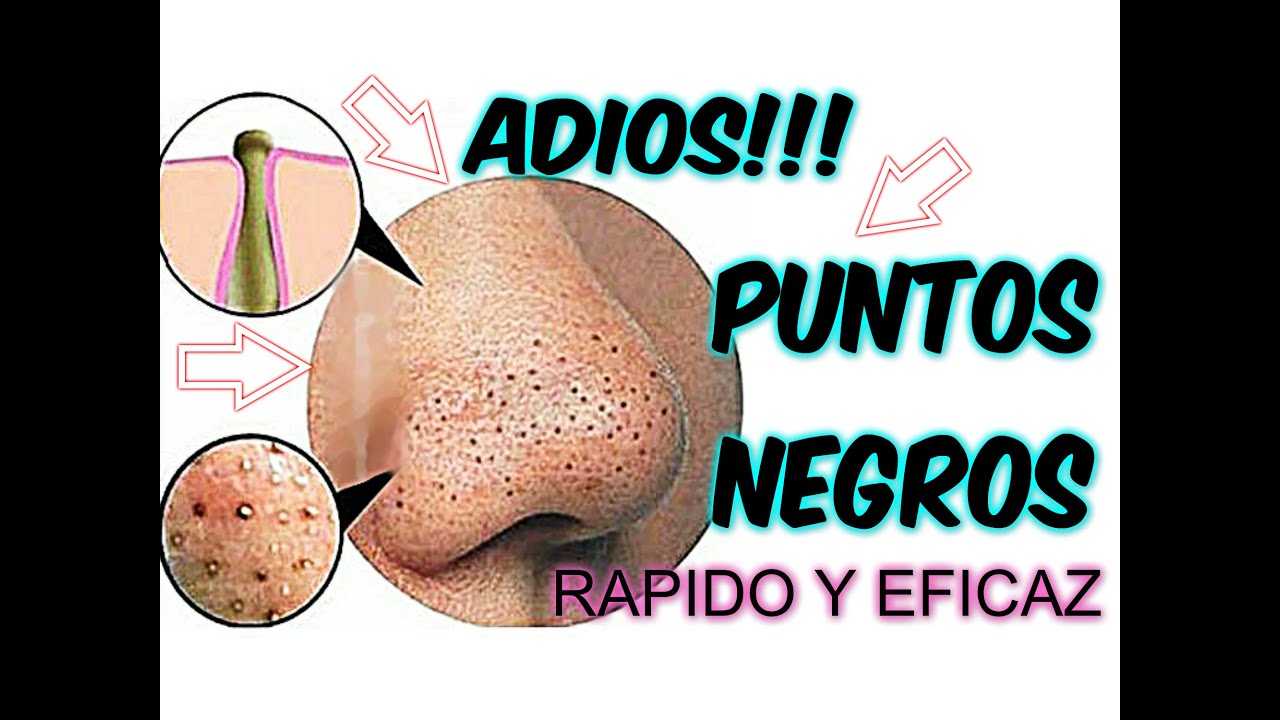 ADIOS! PUNTOS NEGROS en 3 PASOS SUPER SENCILLOS | AANGIE 