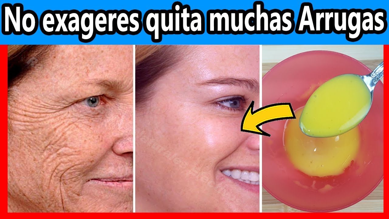 Mezcla estos 2 ingrediente y dile adiós a LAS MANCHAS, Punto Negro, líneas de Expresión o Arrugas. 