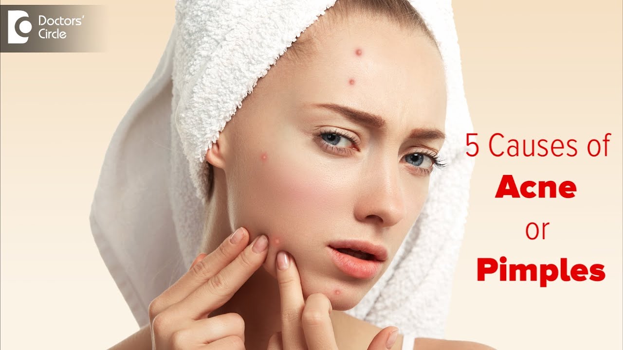 Why do I get ACNE? 5 Top Causes of Acne| Role of Hormones & Genes-Dr. Renuka Shetty| Doctors' Circle 