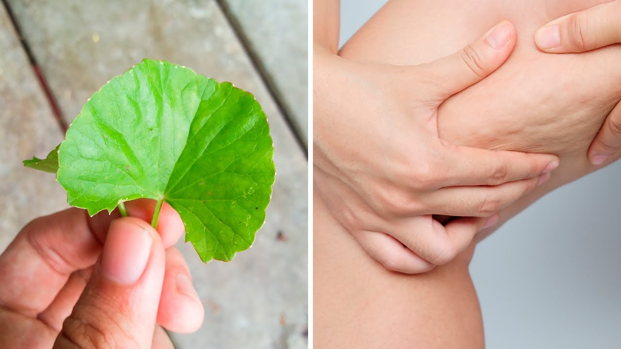 Gotu Kola: The Secret Weapon To Fight Cellulite, Varicose Veins and More 