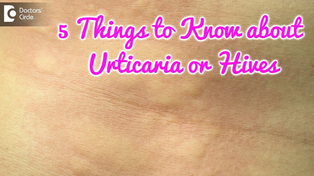Tips to identify Urticaria. Complications & best Treatment-Dr. Amrita Hongal Gejje | Doctors' Circle 
