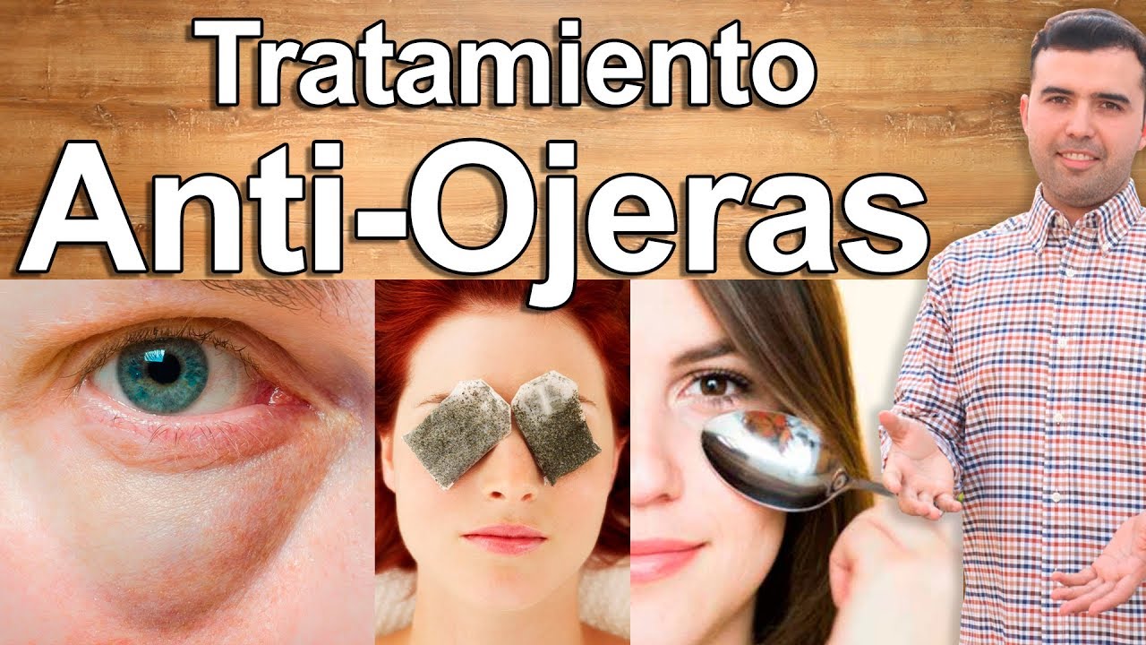 ADIÓS OJERAS Y BOLSAS EN LOS OJOS EN MINUTOS Y PARA SIEMPRE - Remedios Caseros Para Eliminarlas 