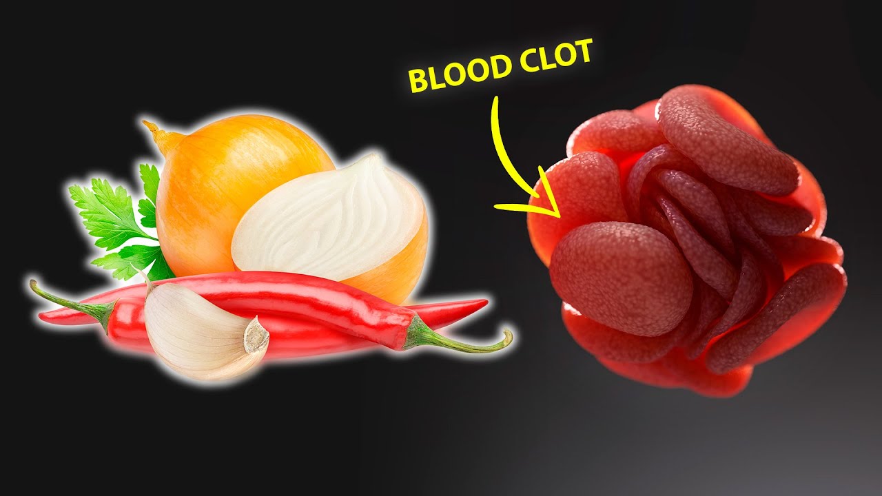 9 Blood Thinning Foods To Reduce Blood Clots And The Risk Of Stroke 