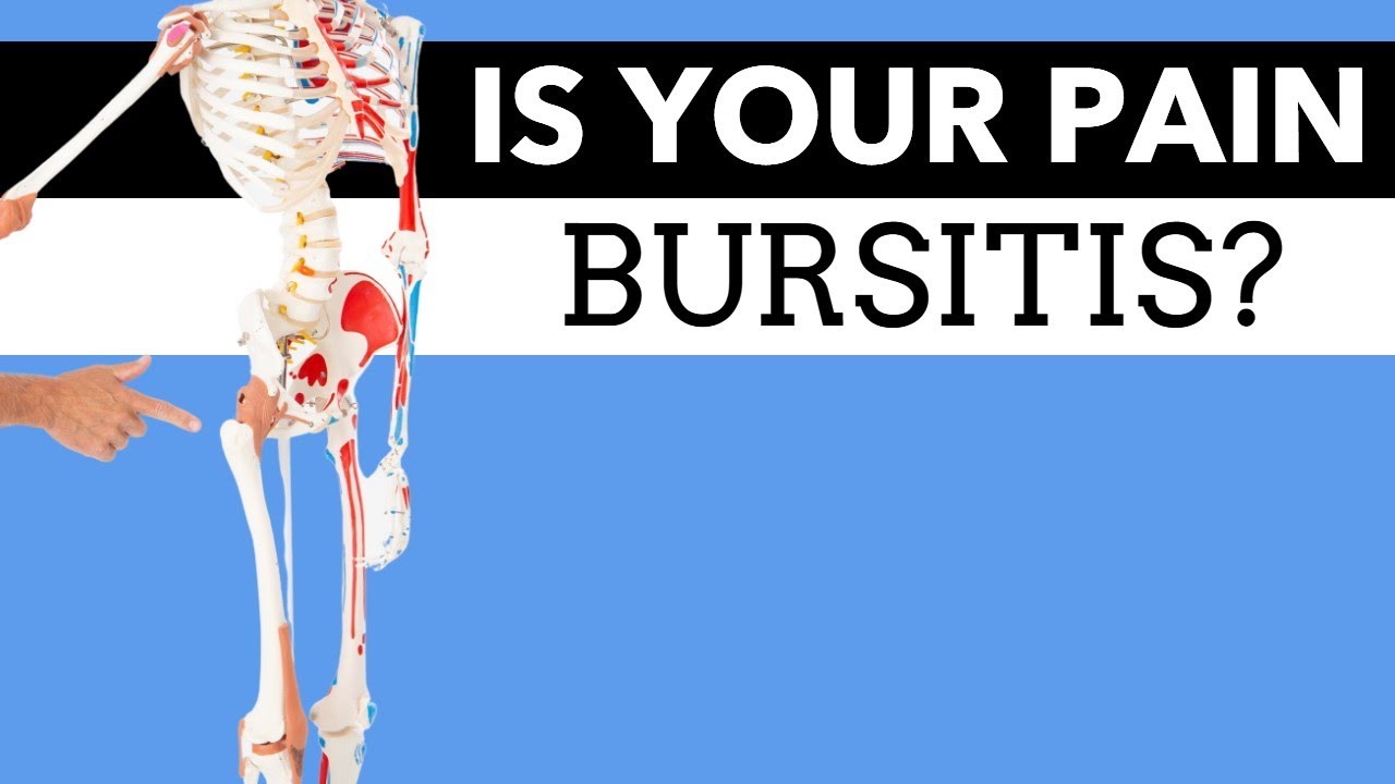 What Is Causing Your Hip Pain? Bursitis? How to Tell. 