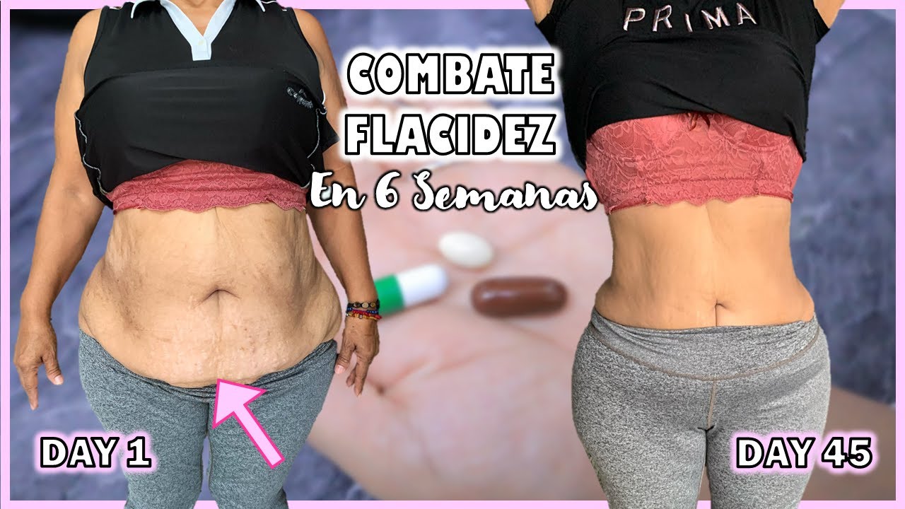 Combate FLACIDEZ EXCESIVA EN 6 SEMANAS | Mujer de 60 años lo prueba