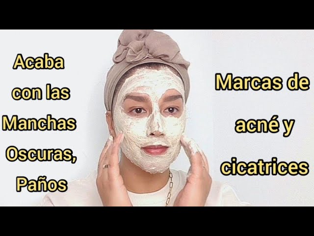 Mascarilla natural para tratar las MANCHAS OSCURAS y MARCAS de ACNÉ